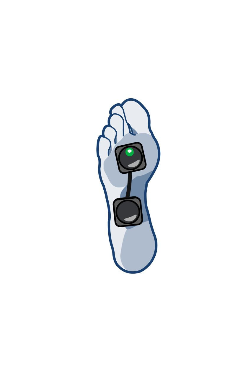 Foot electrode placement for men with wireless Compex EMS muscle stimulator